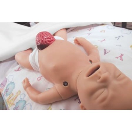 LAERDAL Congenital Anomalies Kit 220-03550